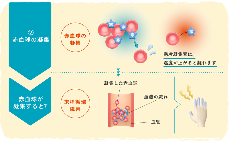 ②赤血球の凝集イメージイラスト