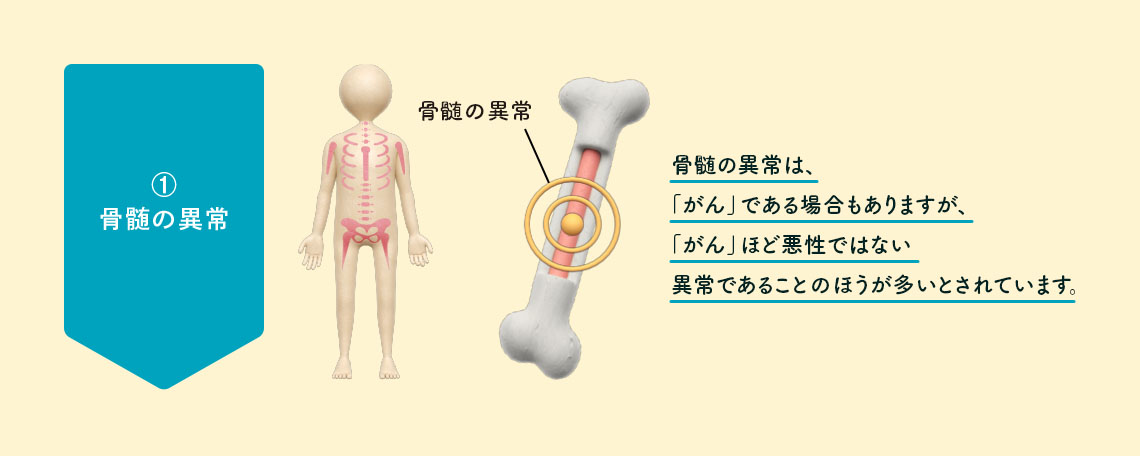 ①骨髄の異常 イメージイラスト