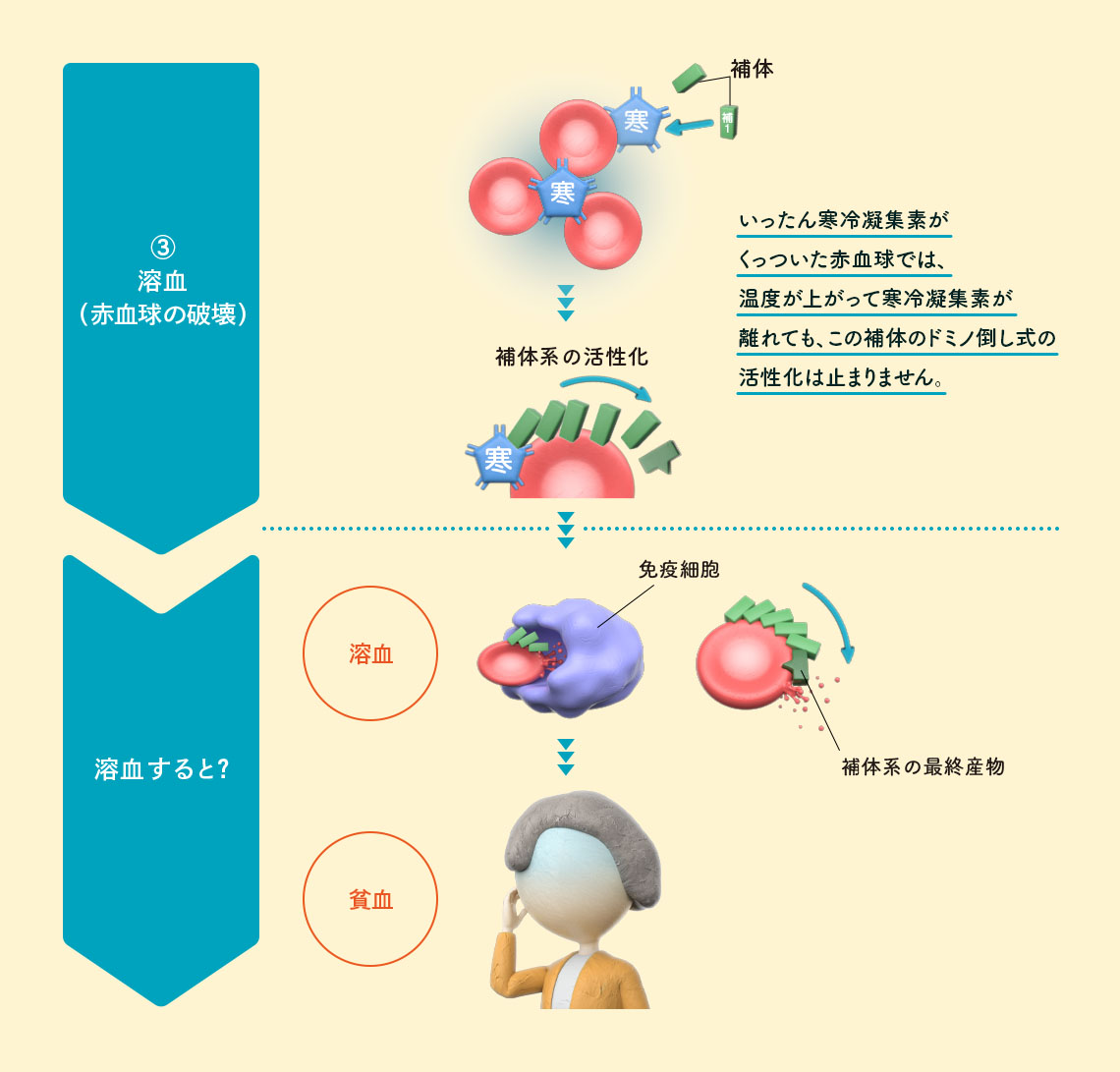 ③溶血（赤血球の破壊） イメージイラスト