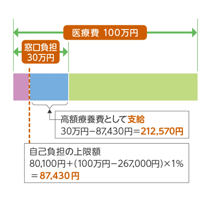 医療費100万円で、窓口の支払い（3割）が30万円の場合 イメージ